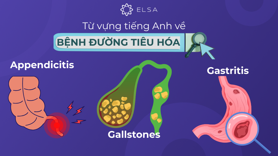 Từ vựng tiếng Anh về các loại bệnh đường tiêu hóa Từ vựng tiếng Anh về các loại bệnh đường tiêu hóa