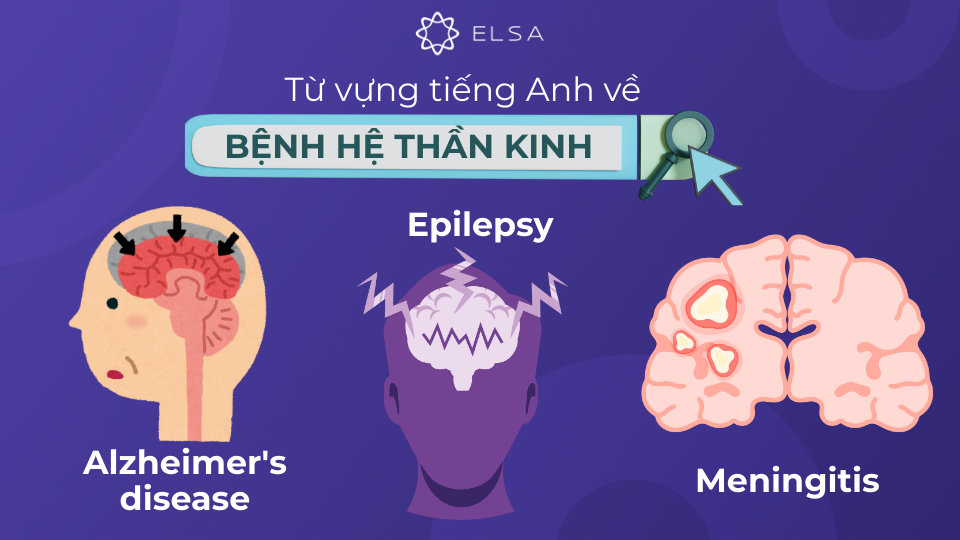 Từ vựng tiếng Anh về các loại bệnh hệ thần kinh Từ vựng tiếng Anh về các loại bệnh hệ thần kinh