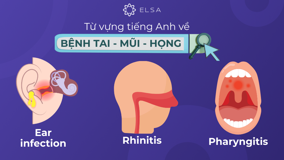 Từ vựng tiếng Anh về các loại bệnh tai - mũi - họng Từ vựng tiếng Anh về các loại bệnh tai - mũi - họng