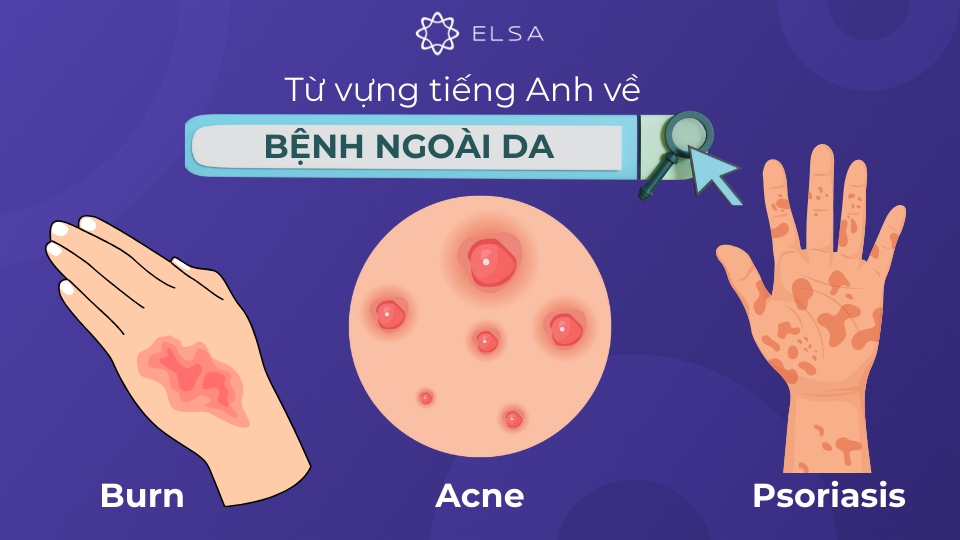 Từ vựng tiếng Anh về các loại bệnh ngoài da Từ vựng tiếng Anh về các loại bệnh ngoài da