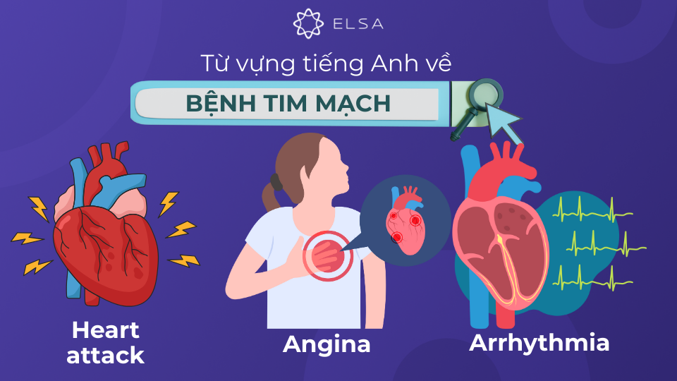 Từ vựng tiếng Anh về các loại bệnh tim mạch Từ vựng tiếng Anh về các loại bệnh tim mạch
