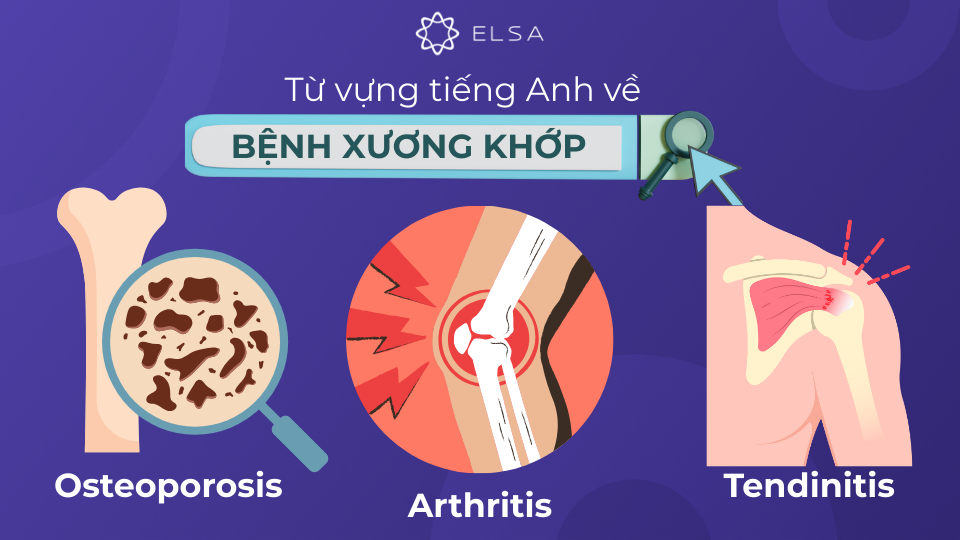 Từ vựng tiếng Anh về các loại bệnh xương khớp Từ vựng tiếng Anh về các loại bệnh xương khớp