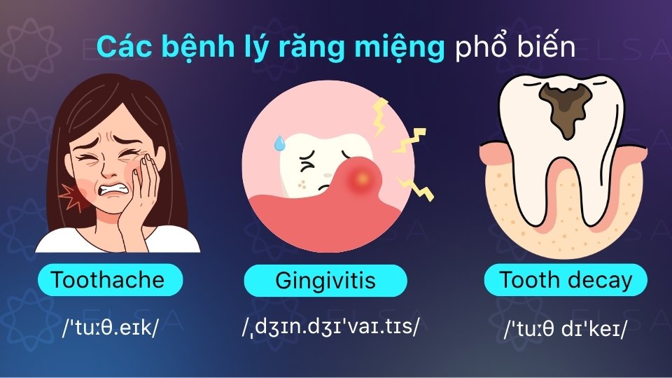 Từ vựng tiếng Anh về bệnh lý nha khoa